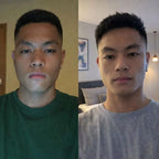 Klyvis Face Sculpting Wrap